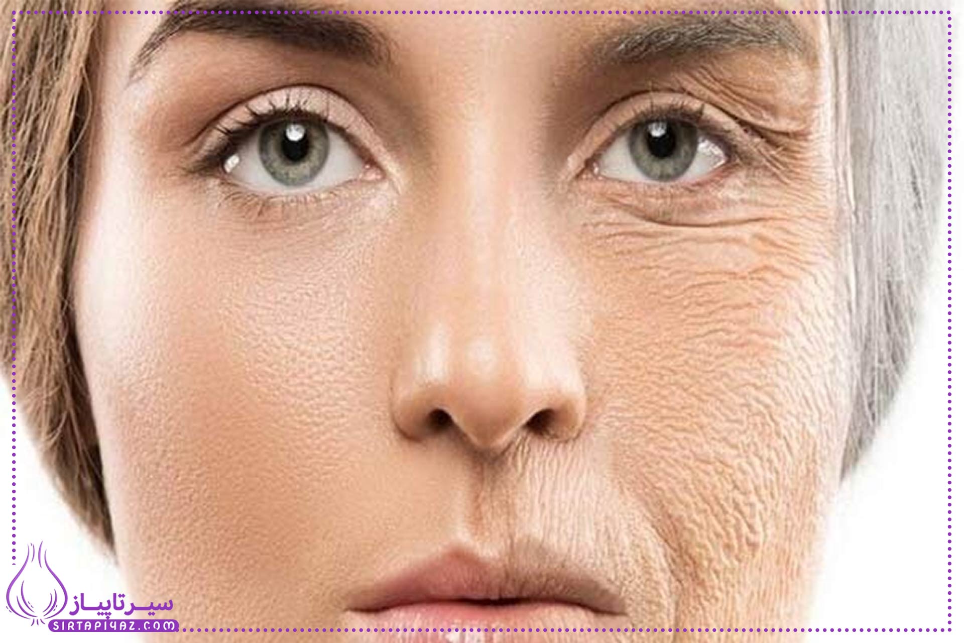 6 راهکار طلایی برای پیشگیری از چین و چروک صورت
