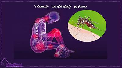 بیماری چیکونگونیا چیست و چگونه منتقل می‌شود؟ | پیشگیری و درمان