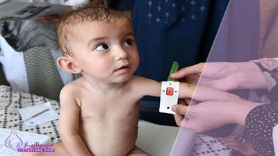 واریز کالا برگ سو تغذیه کودکان + مبلغ