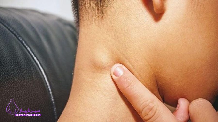 طاعون دبلی | طاعون چیست؟ انواع طاعون، طاعون ریوی و علائم بیماری