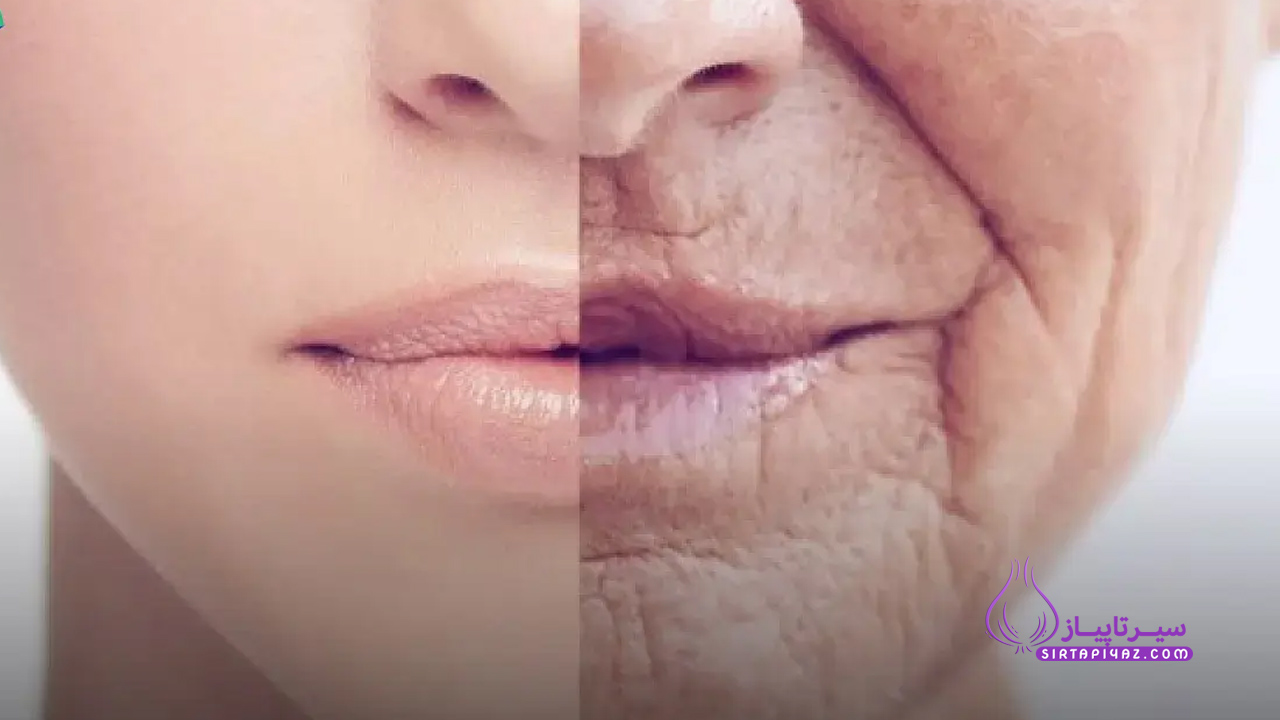 جلوگیری از چین و چروک پوست